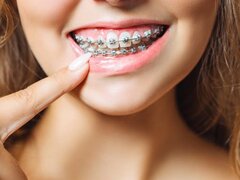 Bellissima - Clinica dentara