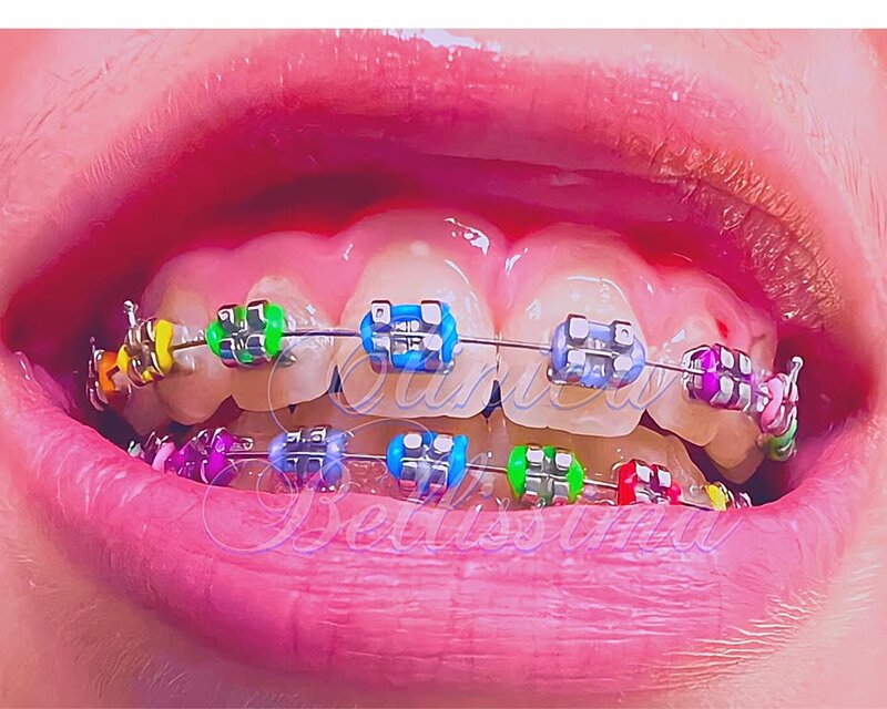 Bellissima - Clinica dentara